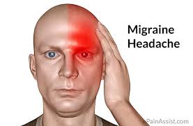 Migraine in Pain Half of the Head