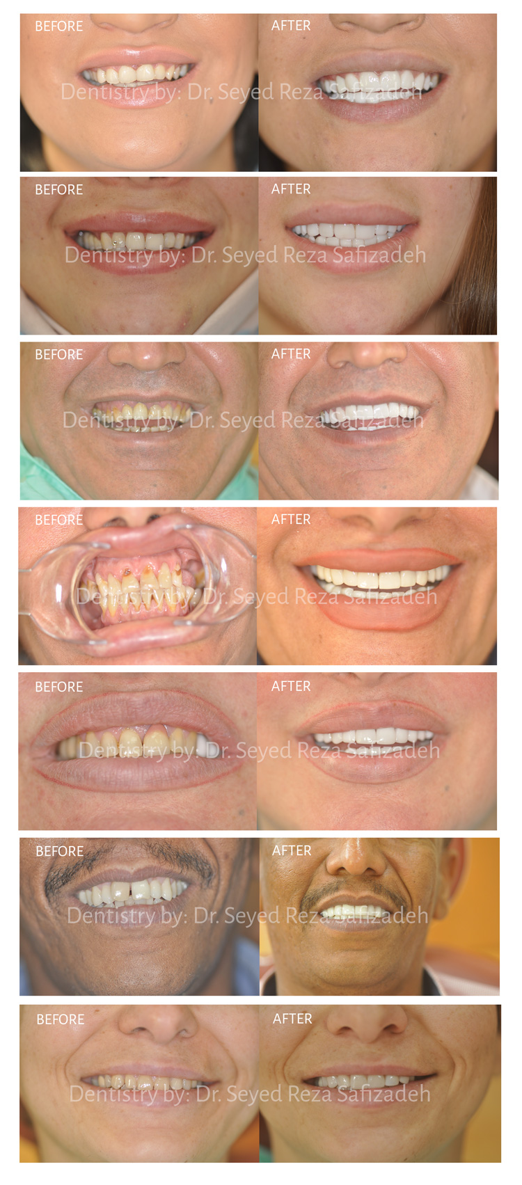 Cosmetic Dentistry